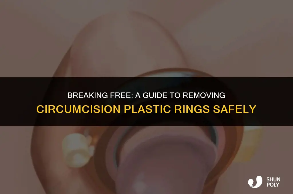 how to do for outside the plastic ring from circumcision