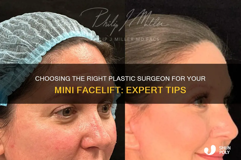 how to find a gh ood plastic surgeon mini facelift