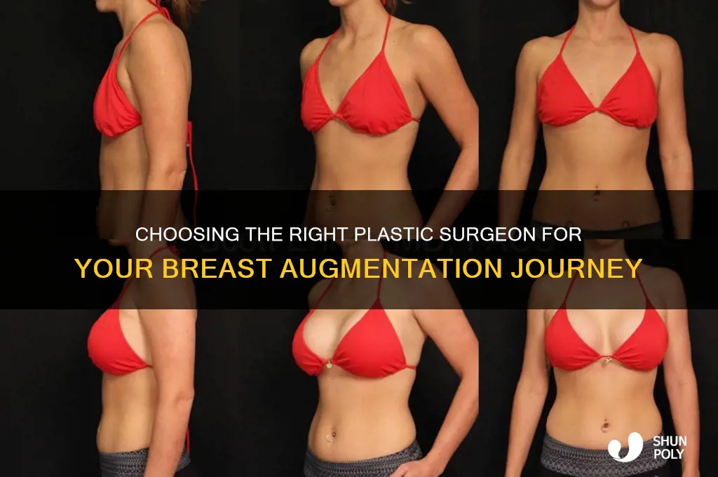 how to find a good plastic surgeon for breast augmentation