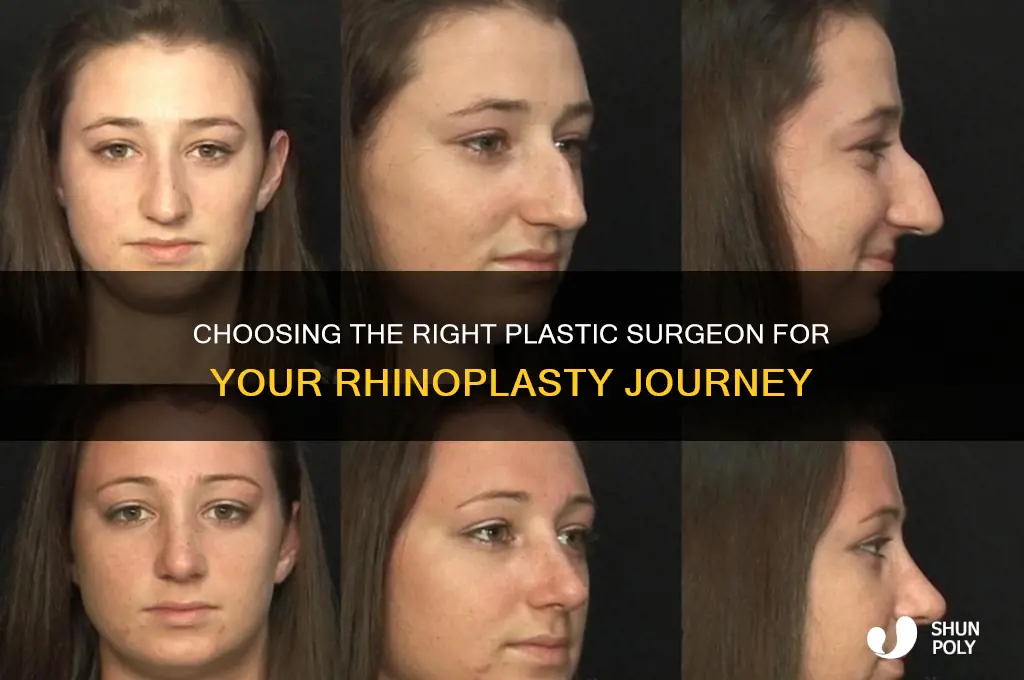 how to find a good plastic surgeon for rhinoplasty