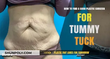 Choosing the Right Plastic Surgeon for Your Tummy Tuck Procedure