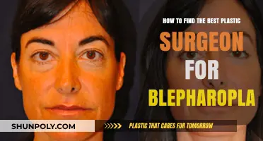 Choosing the Right Plastic Surgeon for Your Blepharoplasty Procedure
