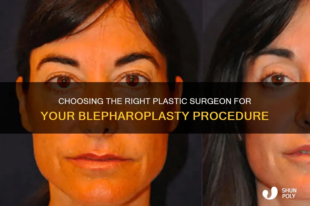 how to find the best plastic surgeon for blepharoplasty