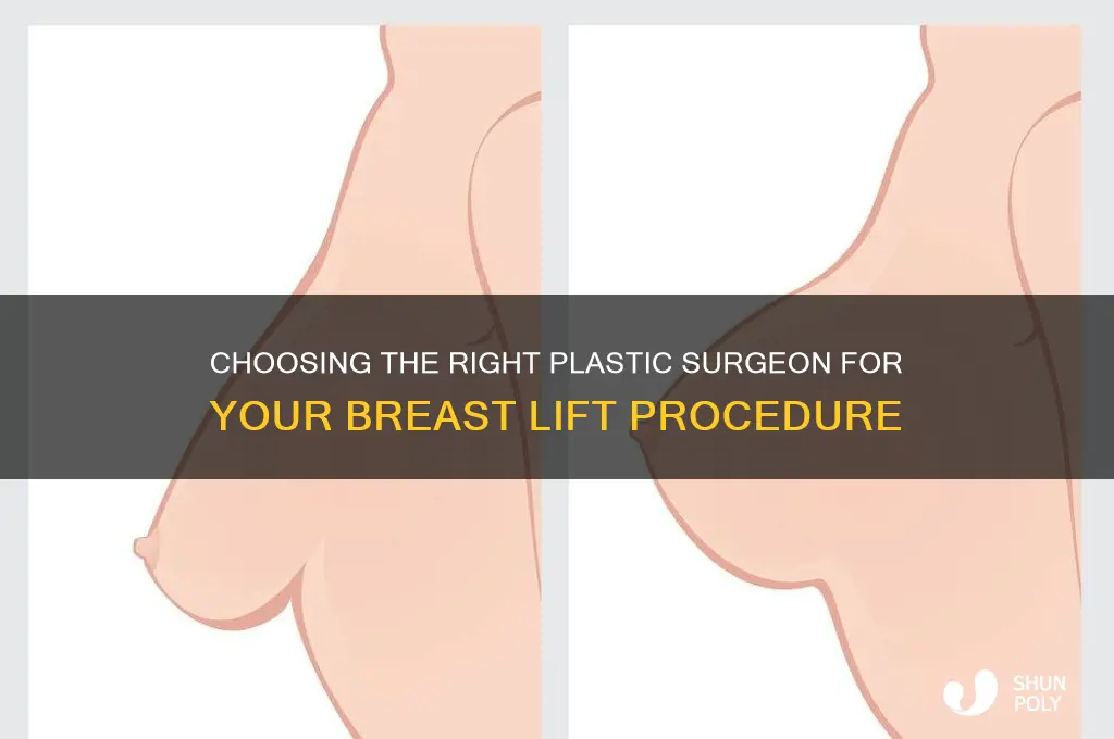 how to find the best plastic surgeon for breast lift
