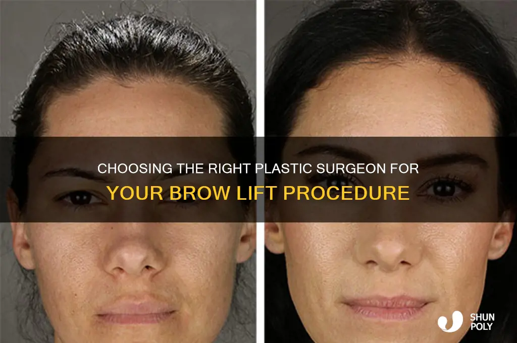 how to find the best plastic surgeon for brow lift