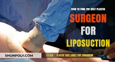 Choosing the Right Plastic Surgeon for Your Liposuction Journey
