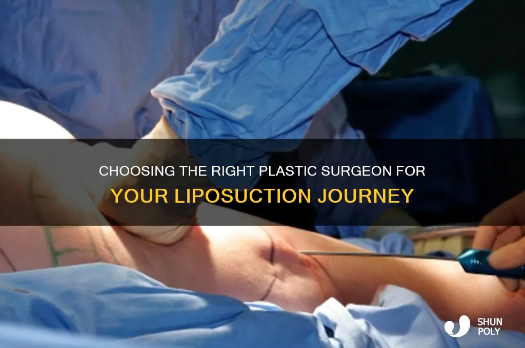 how to find the best plastic surgeon for liposuction