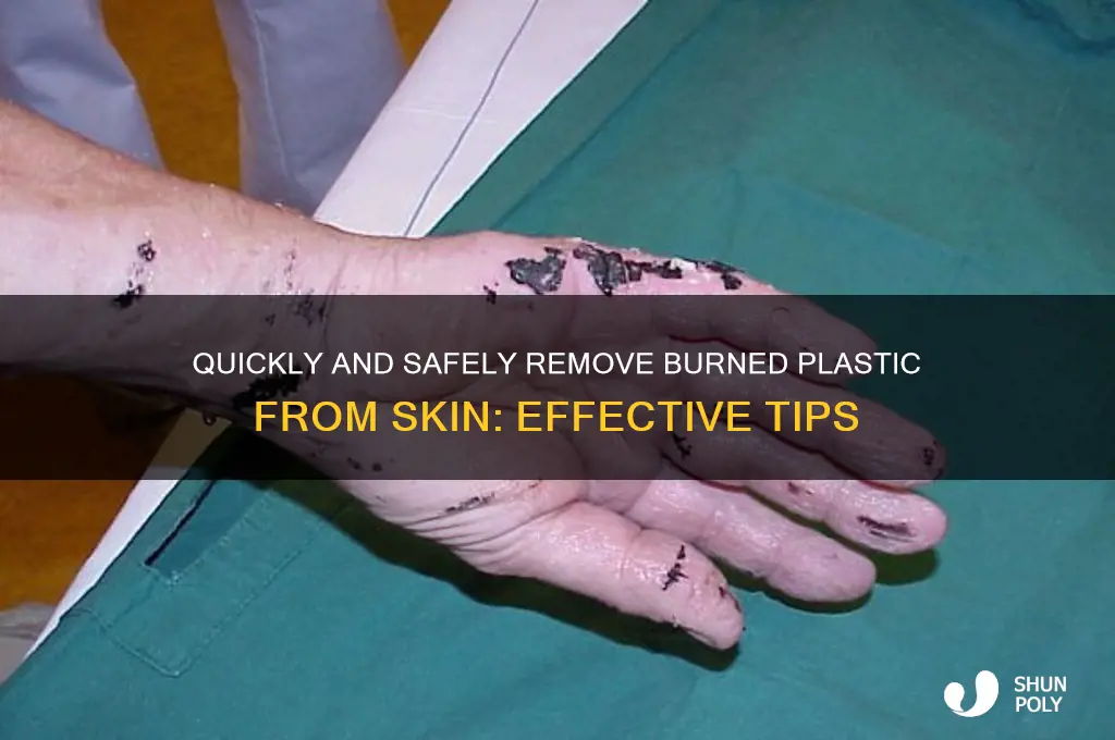 how to get burned plastic off skin