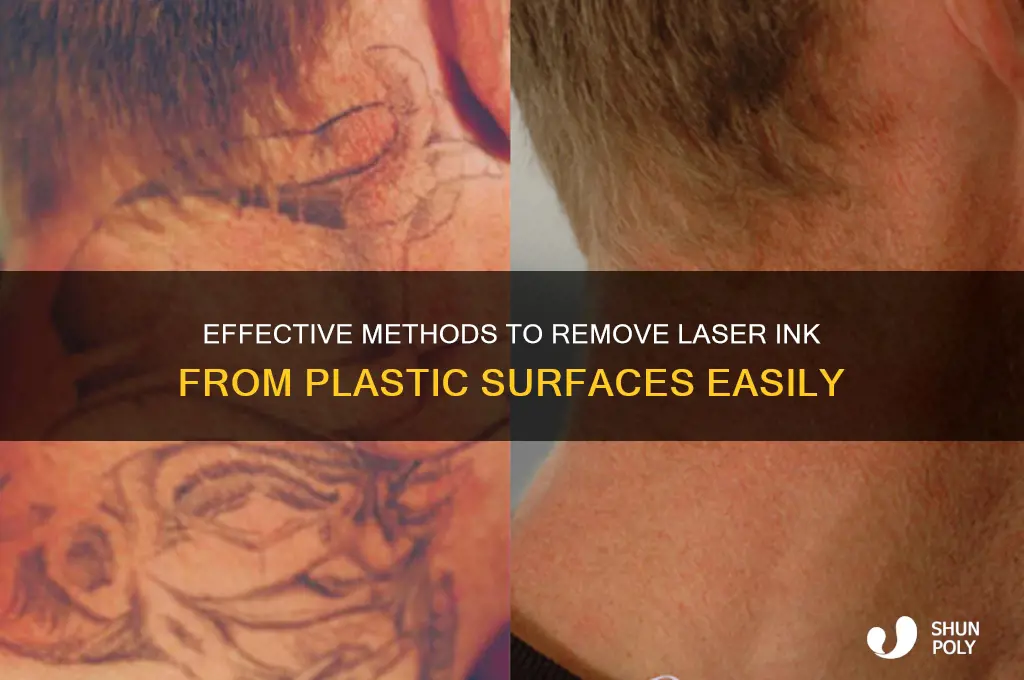 how to get laser ink off of plastic