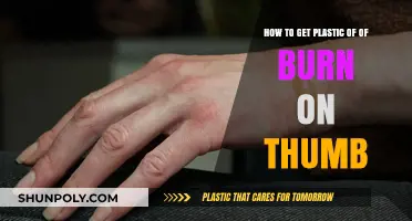 Quick Tips to Remove Melted Plastic from a Burnt Thumb Safely