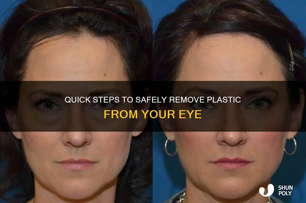 how to get plastic out of eye