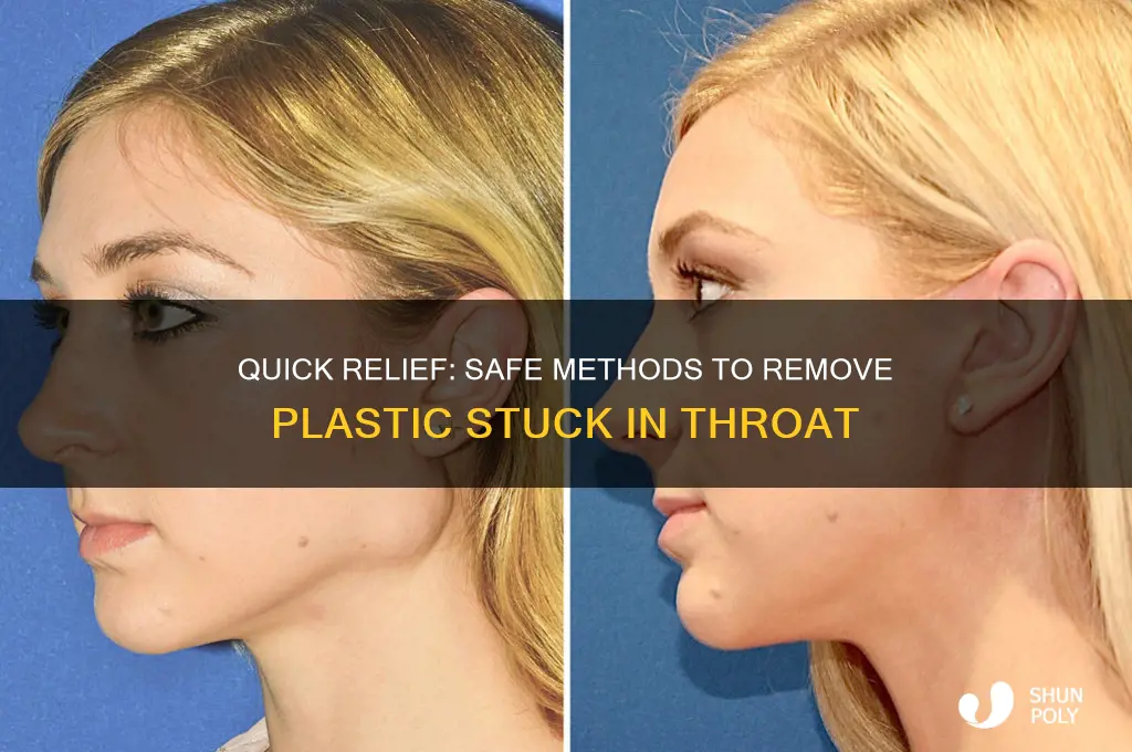 how to get plastic out of throat