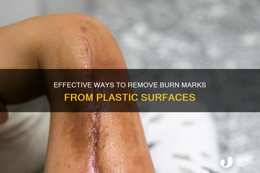 how to get rid of burn marks from plastic