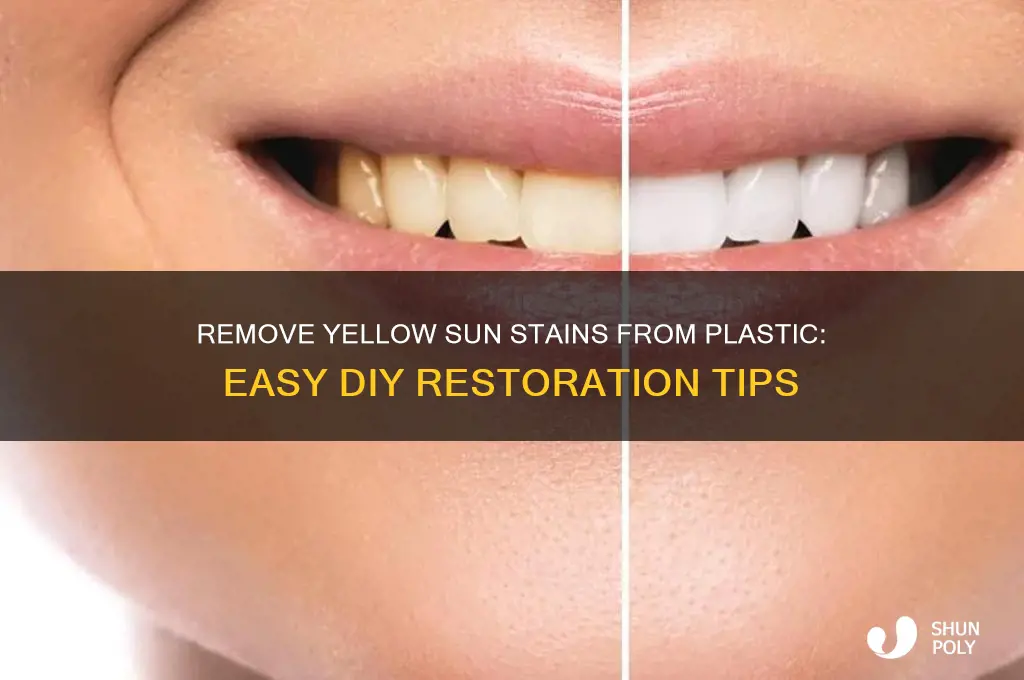 how to get rid of yellow sun stains on plastic