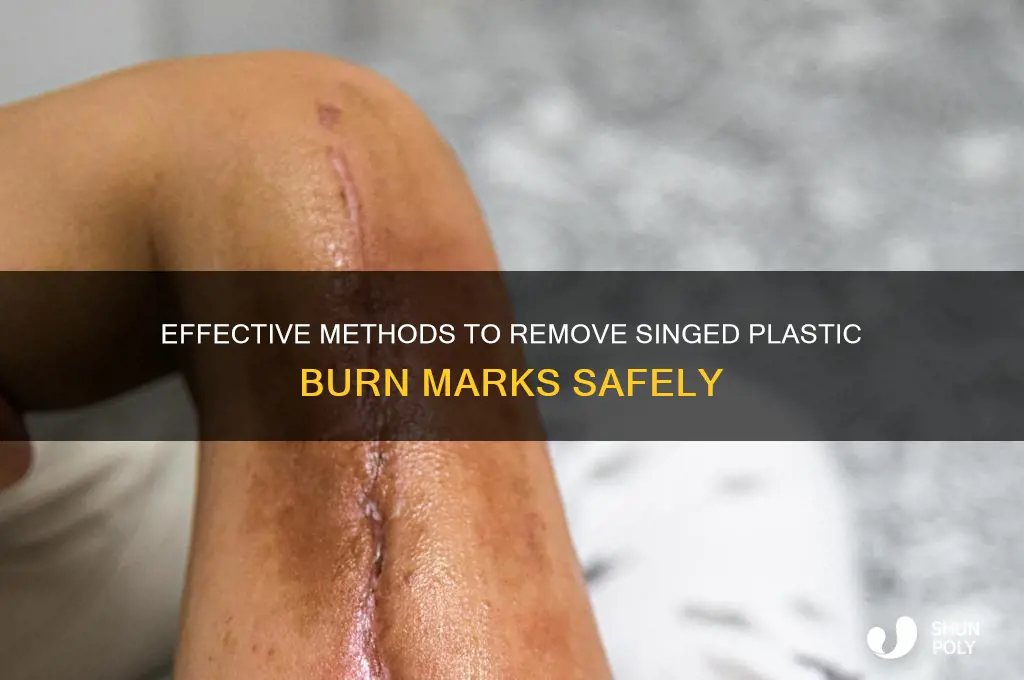how to get singed plastic burn