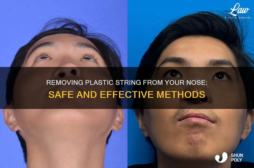 how to get this plastic string out my nose