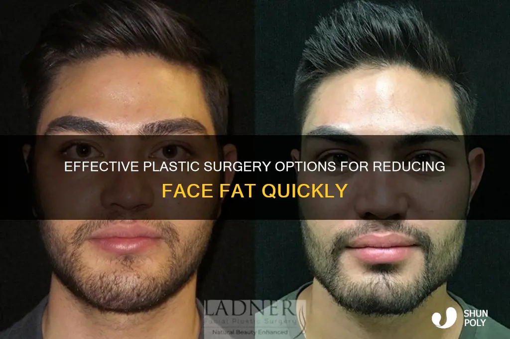 how to lose face fat plastic surgery