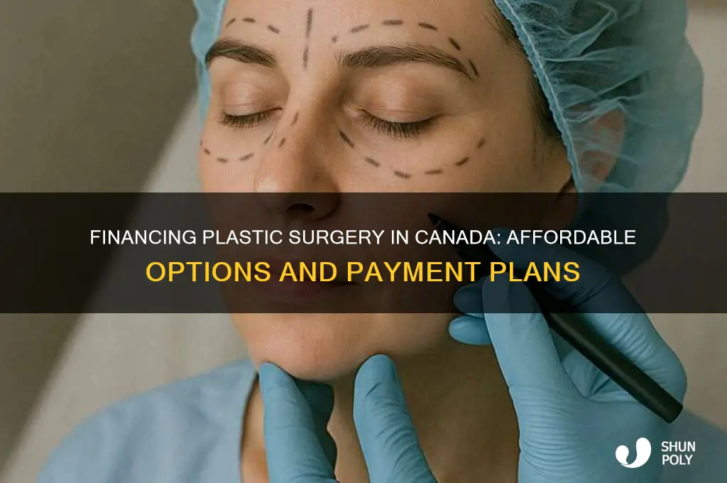 how to pay for plastic surgery canada