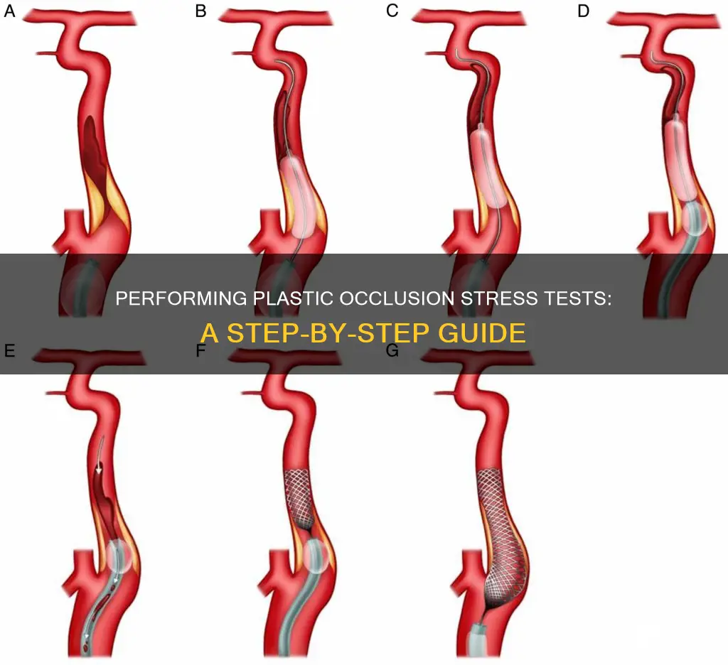 how to perform plastic occlusion stress test
