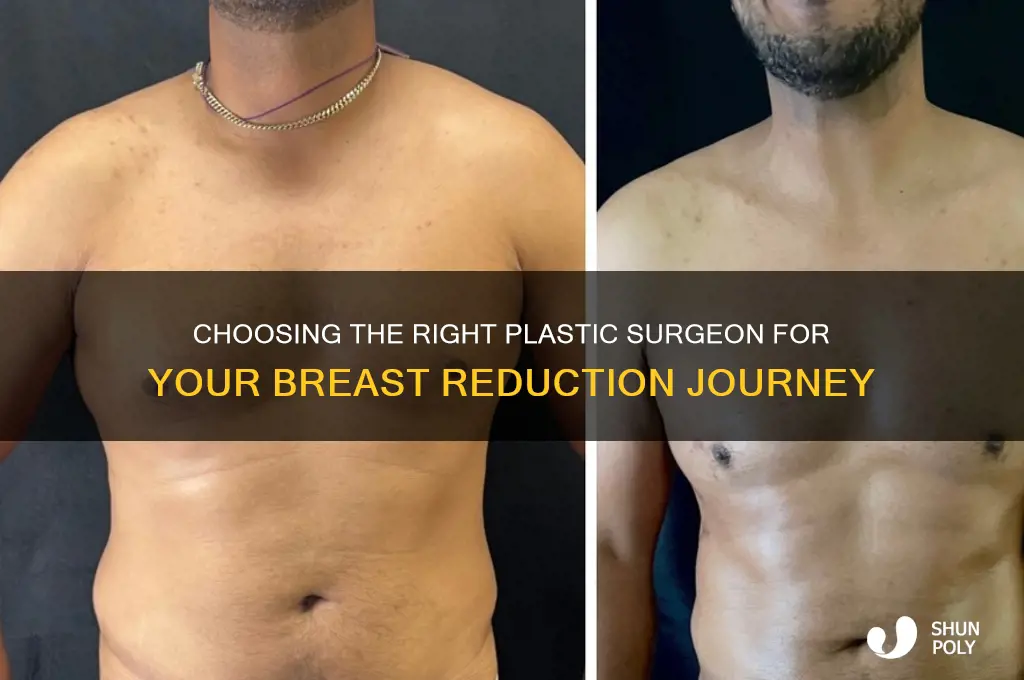 how to pick a plastic surgeon breast reduction
