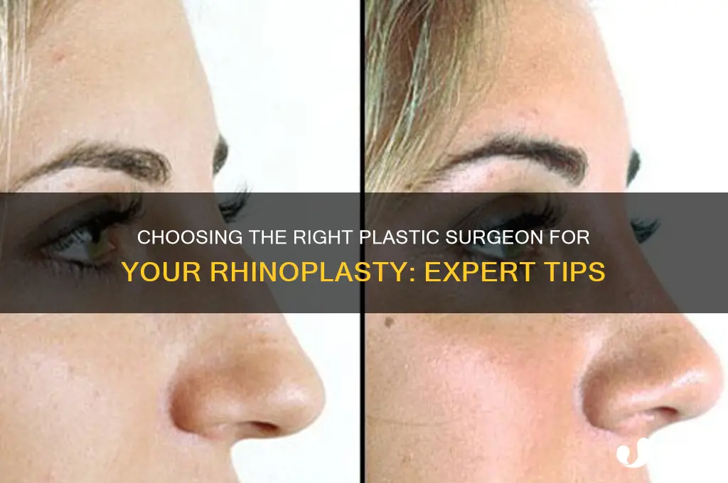 how to pick a plastic surgeon rhinoplasty
