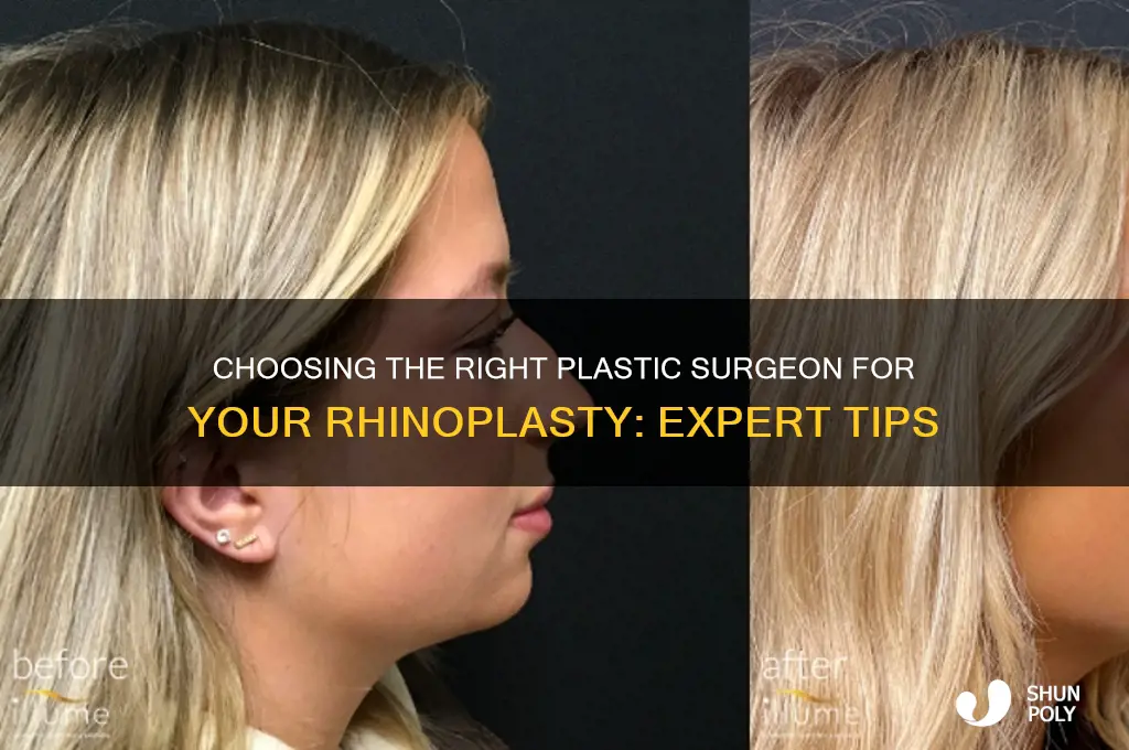 how to pick your plastic surgeon for nose job
