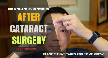 Post-Cataract Surgery Care: Proper Placement of Plastic Eye Protectors