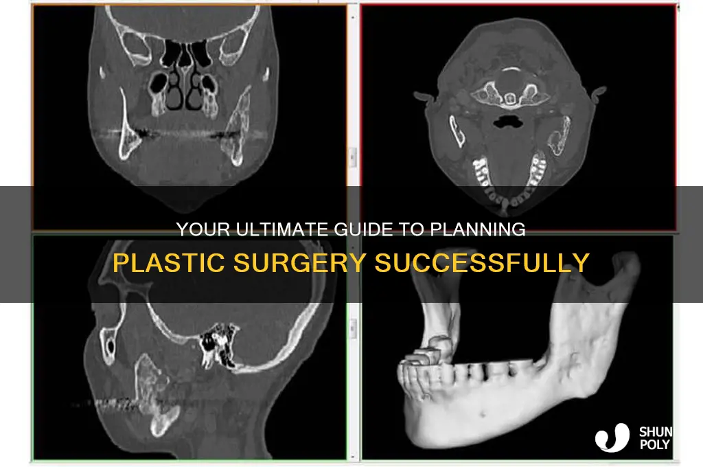 how to plan for plastic surgery