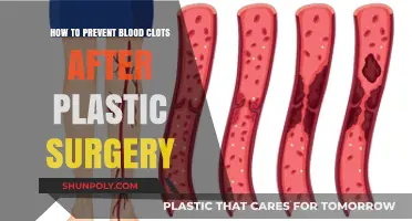 Preventing Blood Clots Post-Plastic Surgery: Essential Tips for Safe Recovery