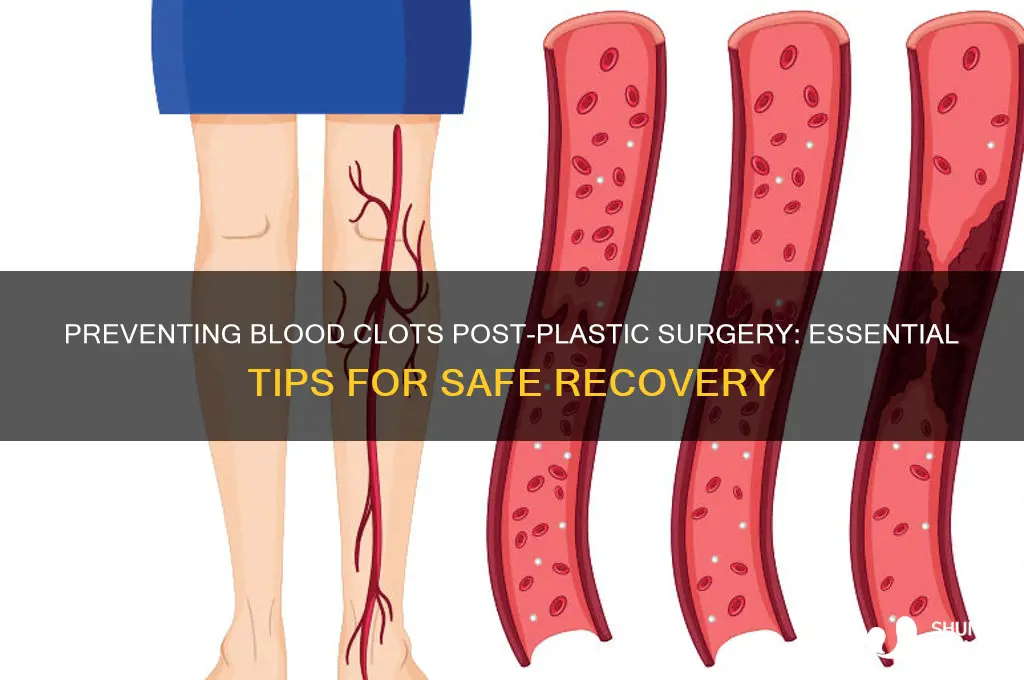 how to prevent blood clots after plastic surgery
