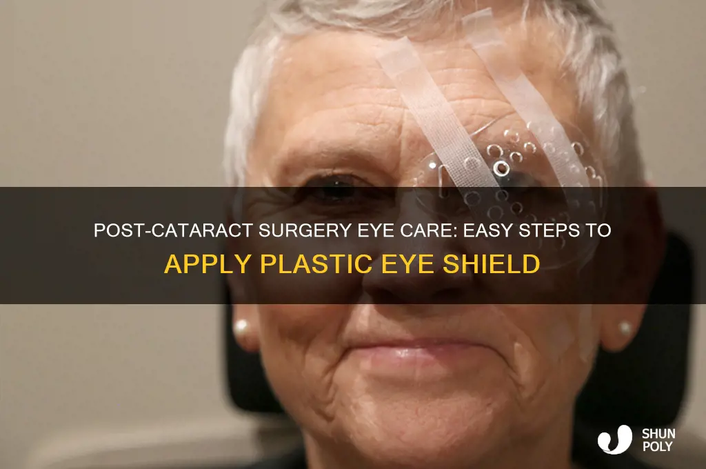how to put on plastic eye shield after cataract surgery