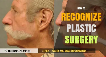 Spotting Plastic Surgery: Key Signs and Subtle Clues to Look For