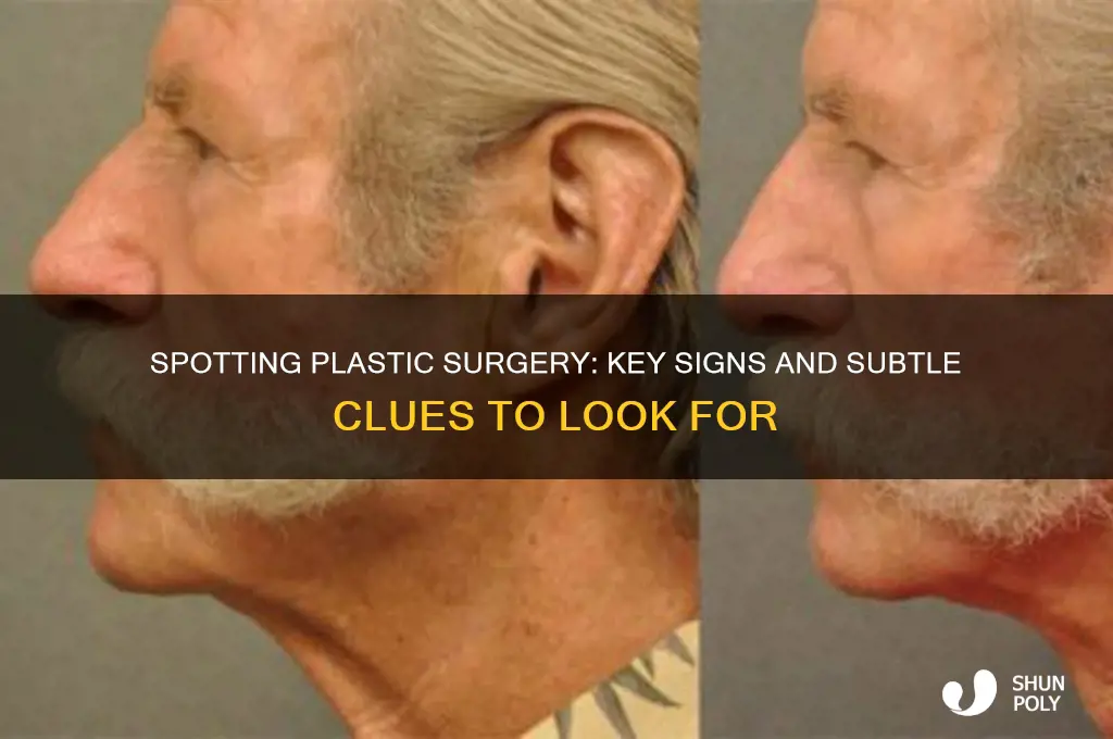 how to recognize plastic surgery