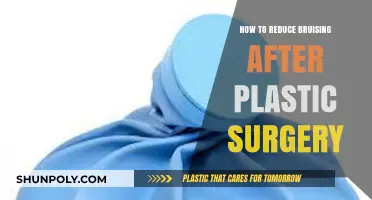 Minimizing Bruising Post-Plastic Surgery: Effective Tips for Faster Healing