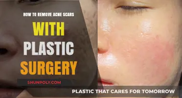Plastic Surgery Solutions: Effective Acne Scar Removal Techniques Explained
