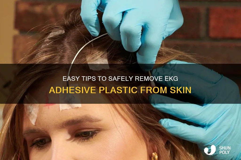 how to remove adhesive plastic from skin after ekg
