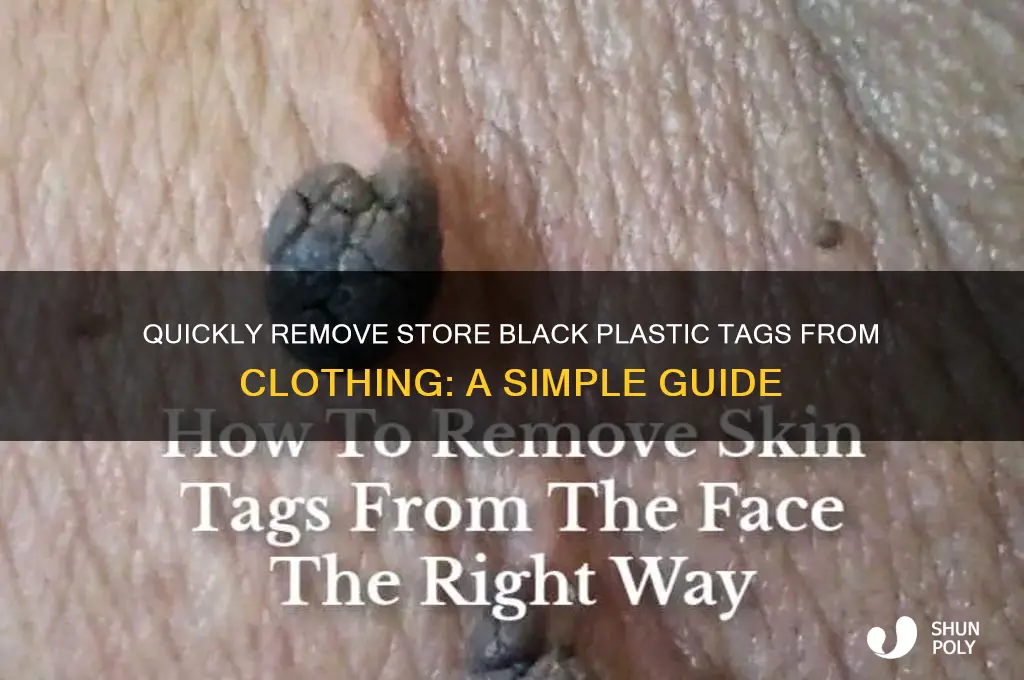 how to remove black plastic device on clothing from store