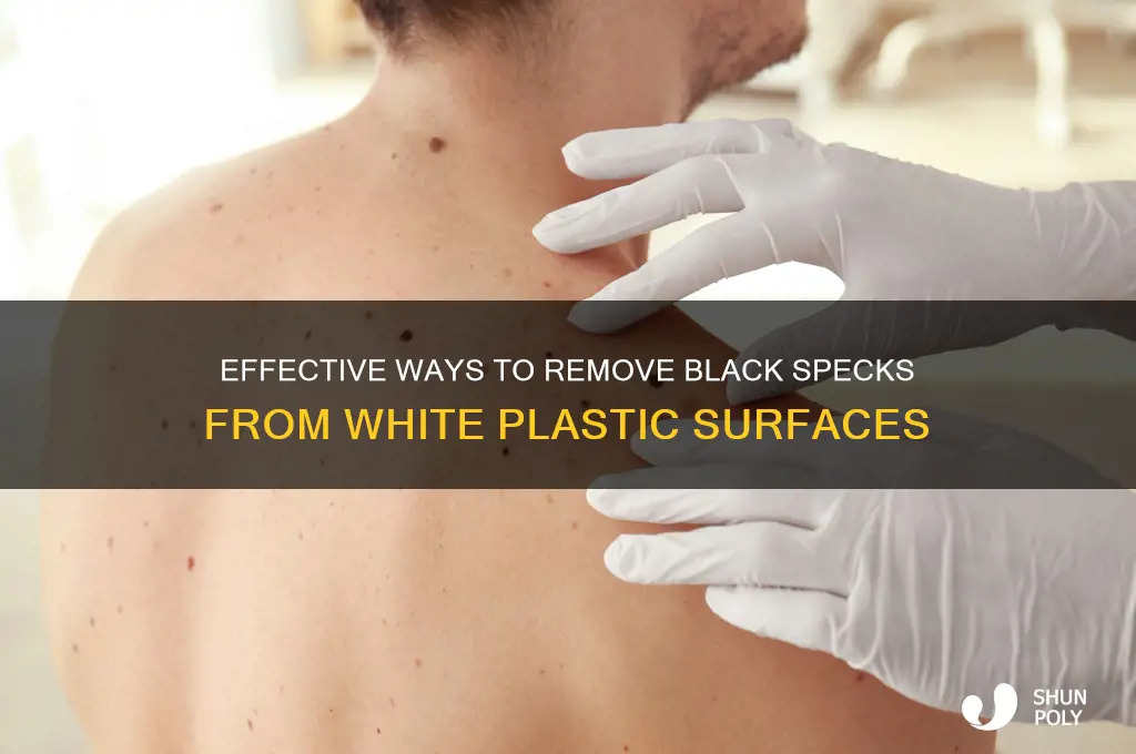 how to remove black speck on white plastic