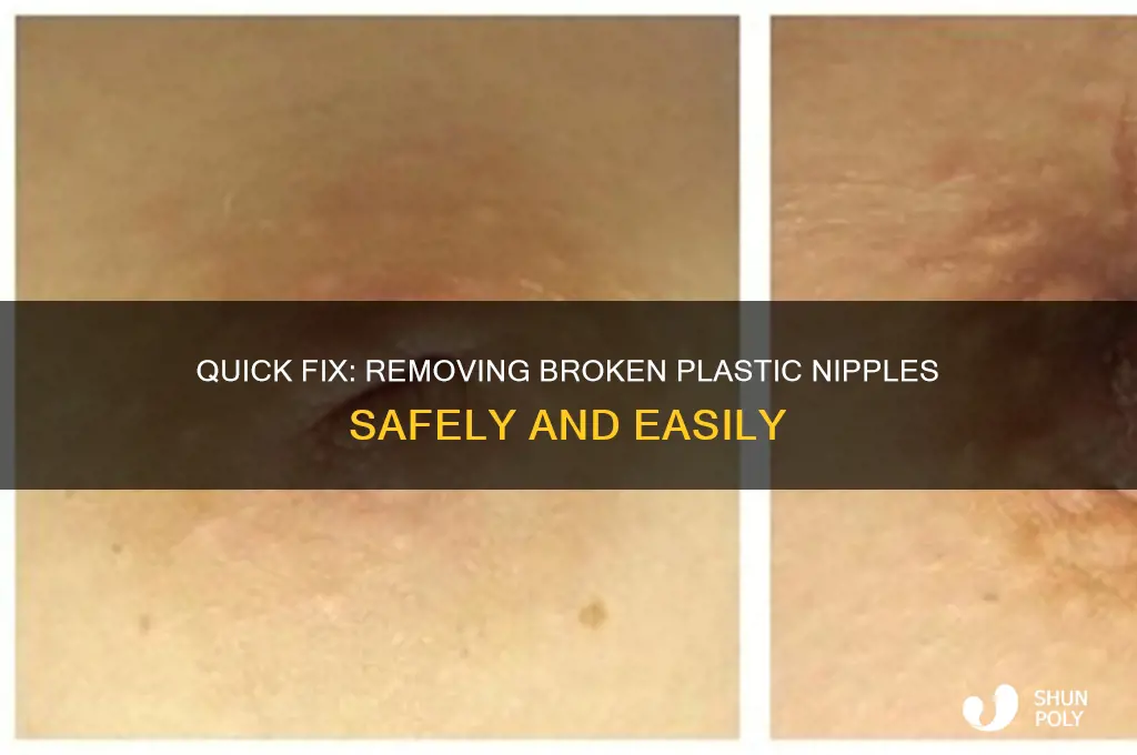 how to remove broken plastic nipple