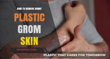 Effective Ways to Safely Remove Burnt Plastic from Skin
