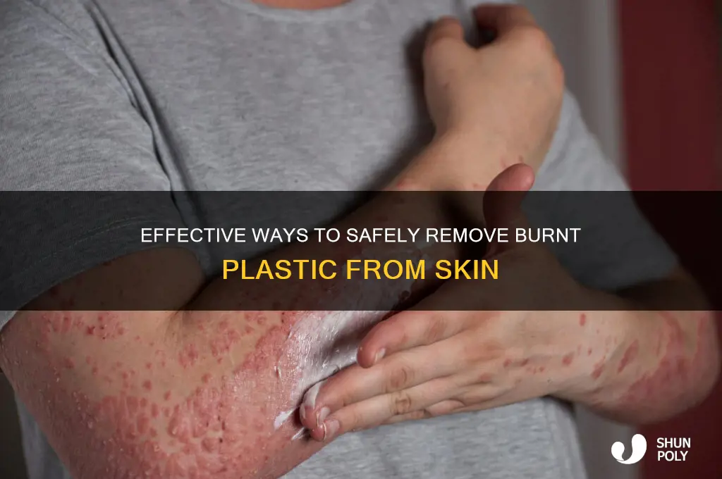 how to remove burnt plastic grom skin