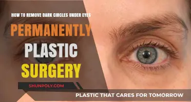 Permanent Dark Circle Removal: Plastic Surgery Solutions for Brighter Eyes