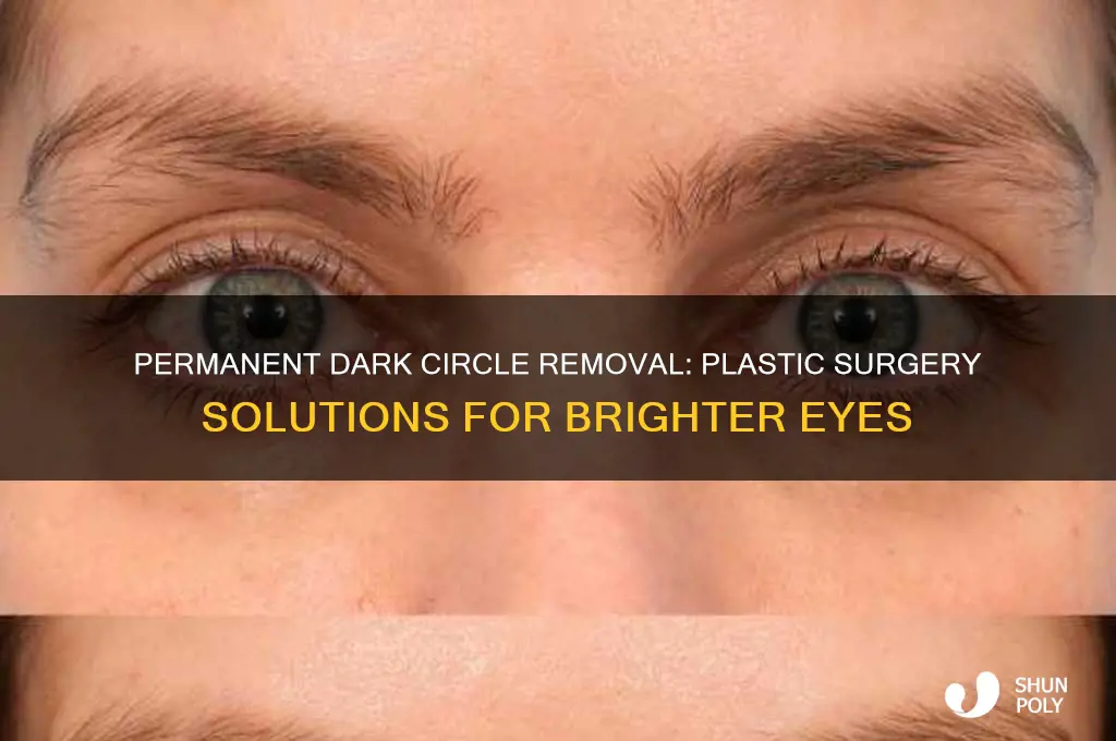 how to remove dark circles under eyes permanently plastic surgery
