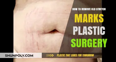 Effective Plastic Surgery Solutions for Removing Old Stretch Marks