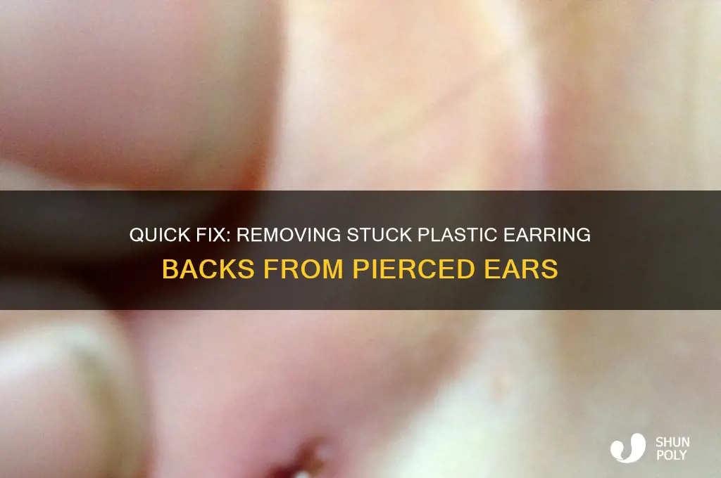 how to remove plastic earring backing from inside pierced ear