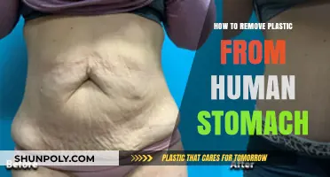 Safe Methods to Remove Ingested Plastic from the Human Stomach