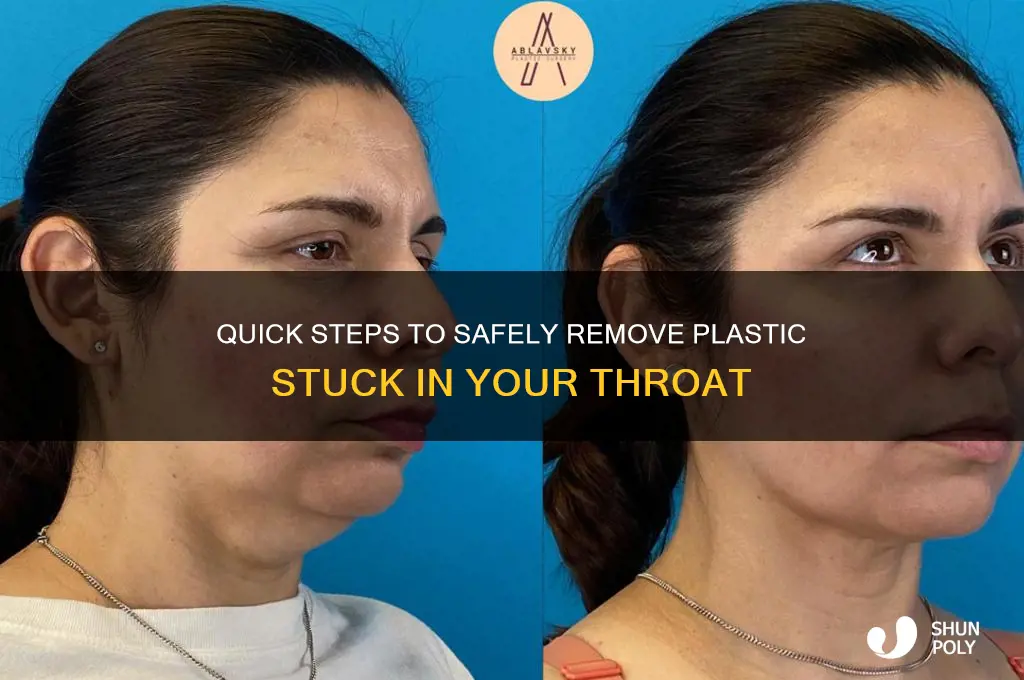 how to remove plastic from your throat