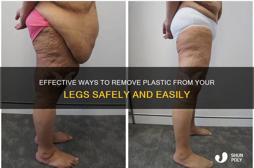 how to remove plastic on legs