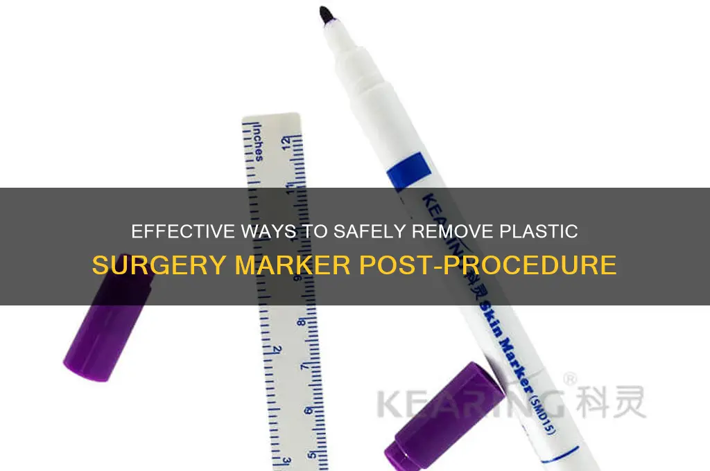 how to remove plastic surgery marker