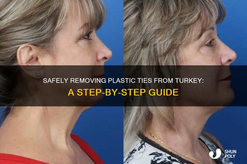 how to remove plastic tie from turkey